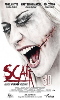 SCAR